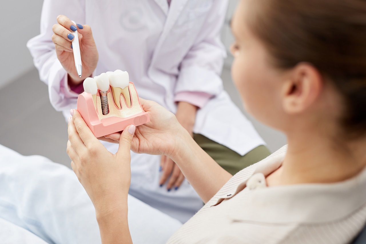 Kiedy warto rozważyć wstawienie implantów zębowych?